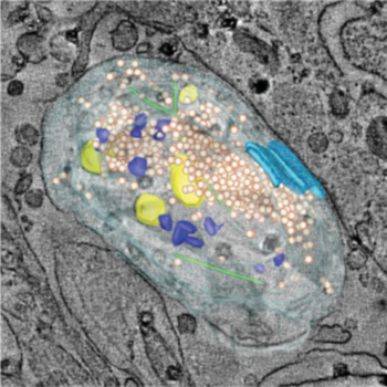 Correlative electrophysiology and automated serial electron tomography of an autaptic synapse